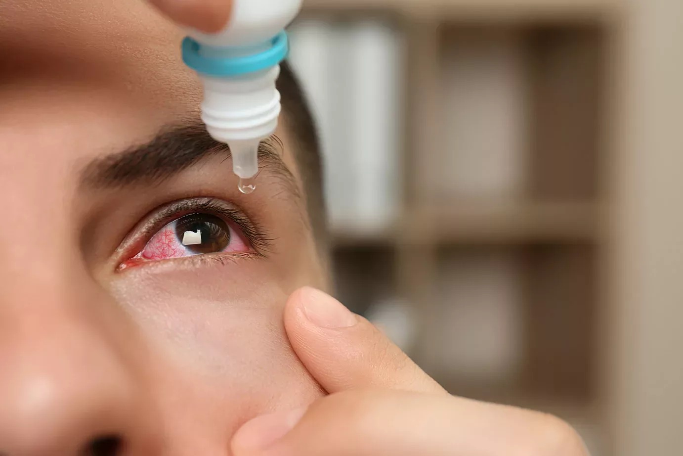 Cách dùng thuốc trị đau mắt đỏ đúng và hiệu quả nhất